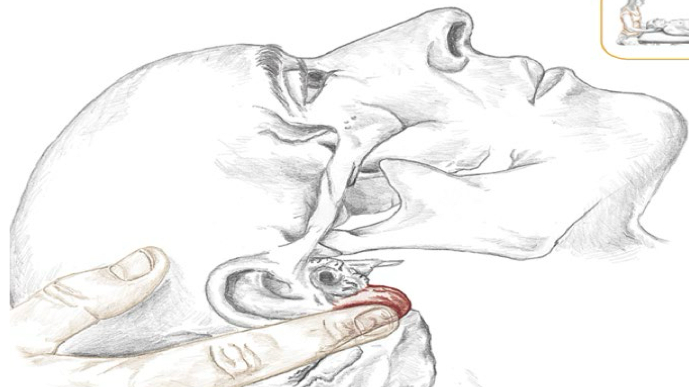 <p>Identify this structure and anatomical significance</p>