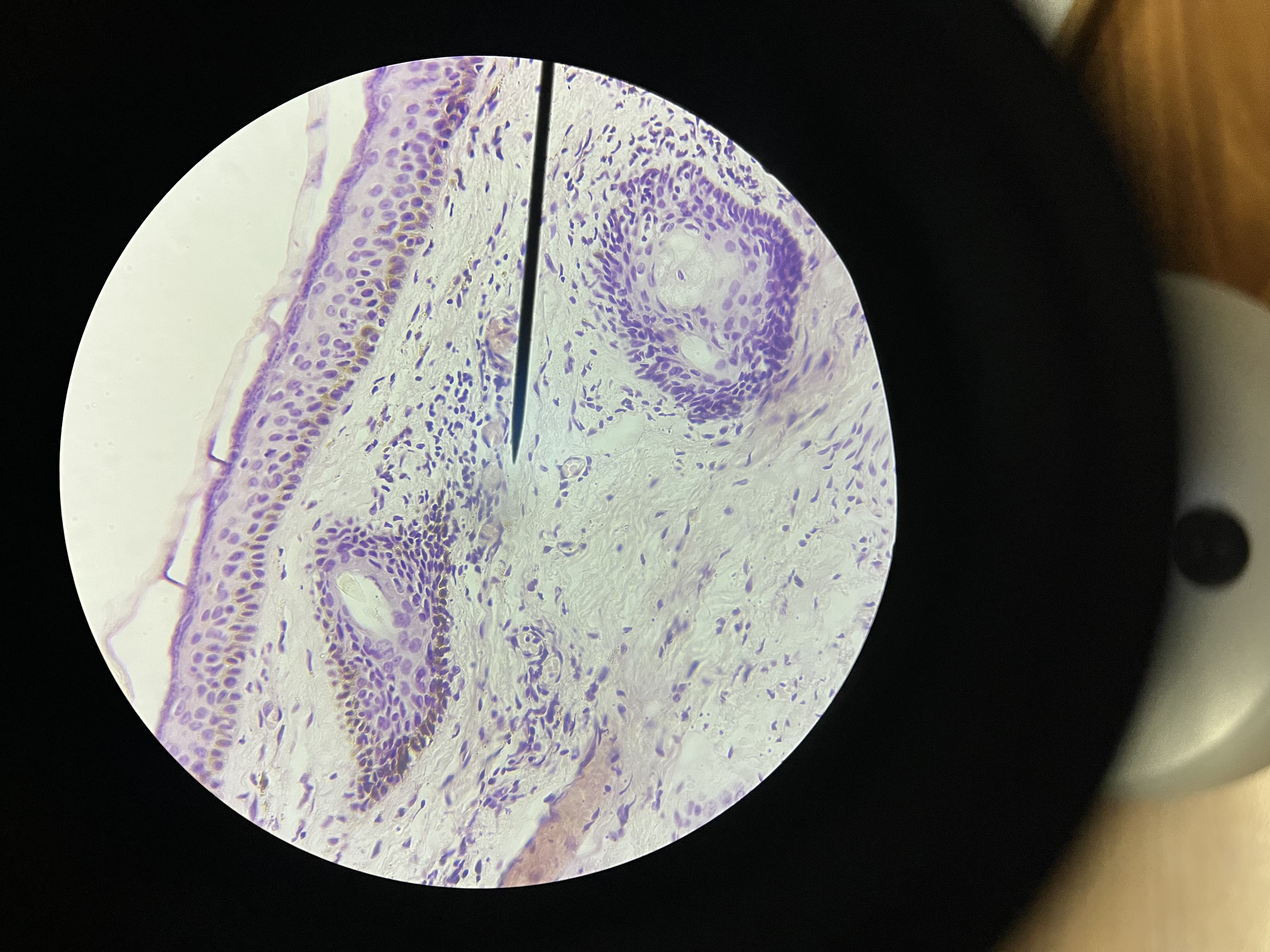<p>What is the diagnosis?</p>