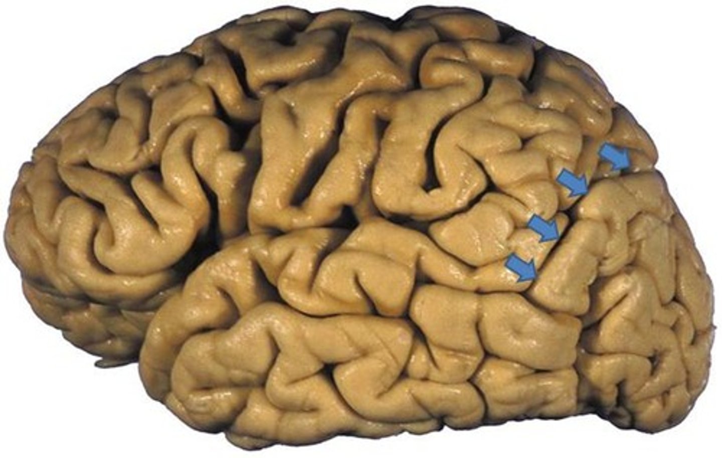<p>separates parietal and occipital lobes</p>