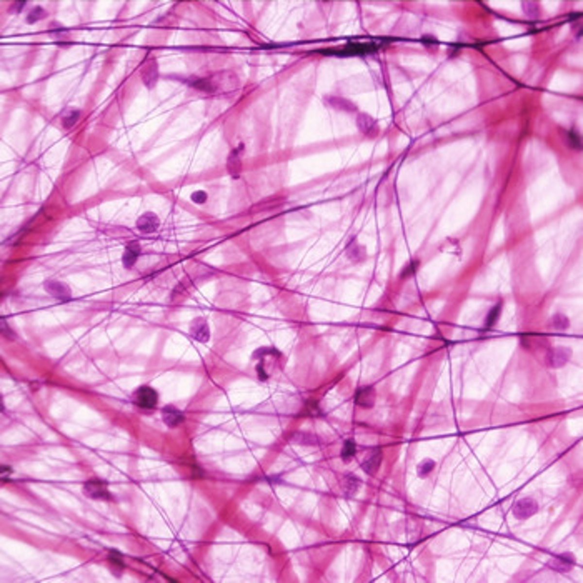 <p>- loose connective tissue</p><p>- gel-like matrix with all three fiber types (fibroblasts, macrophages, and mast cells) and some white blood cells</p><p>- wraps and cushions organs; plays important role in inflammation; holds and conveys tissue fluids</p><p>- located/widely distributed under the skin</p>