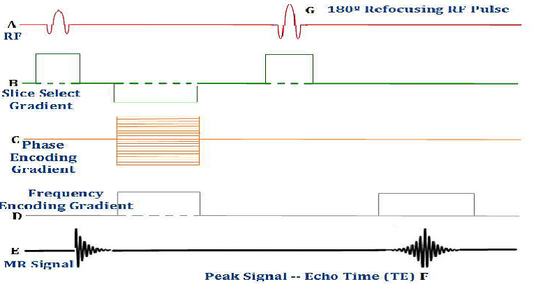 <p><span><span>What is one of the advantages of this pulse sequence?</span></span></p>