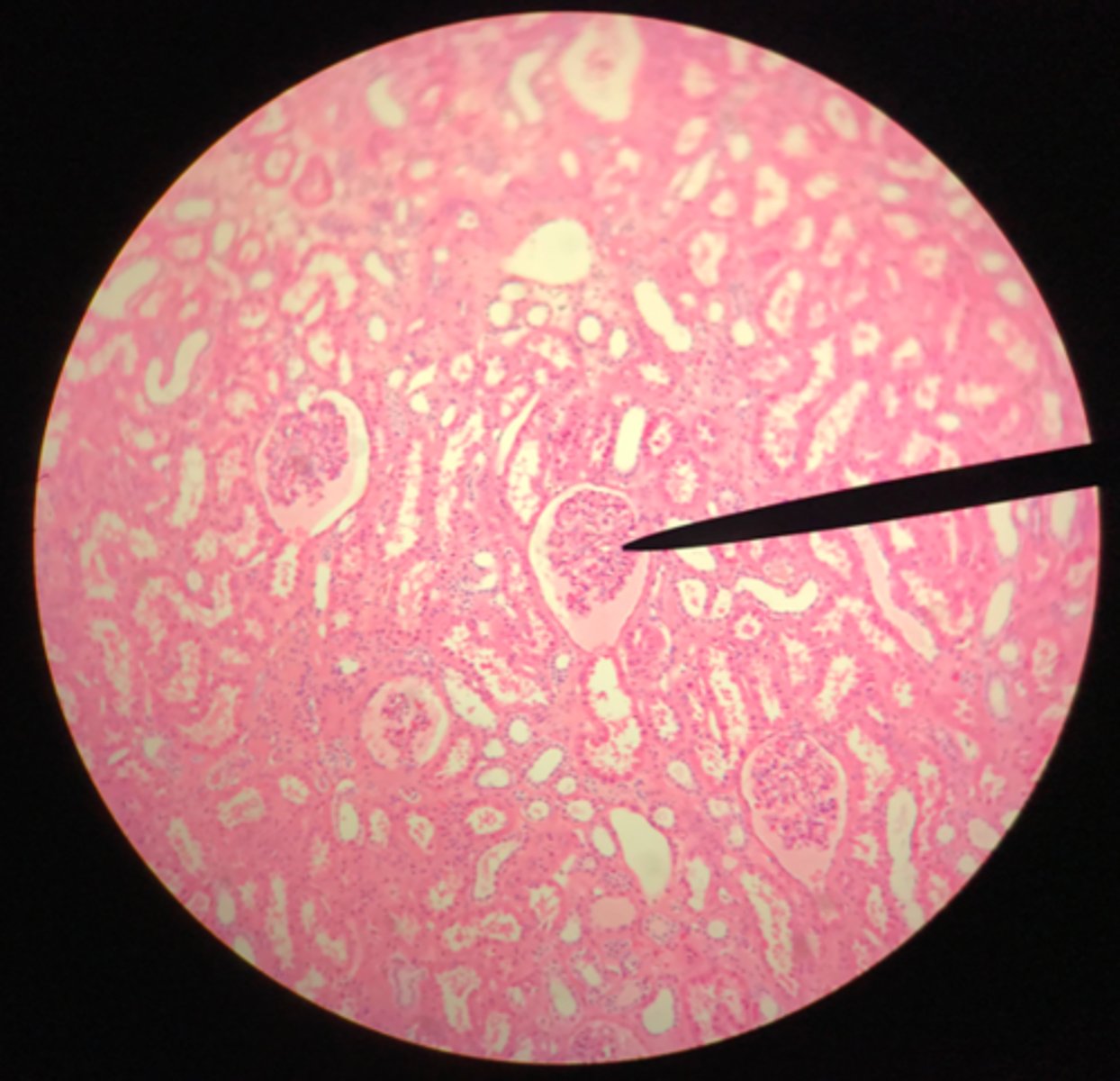 <p>What structure of the kidney is the pointer placed on?</p>