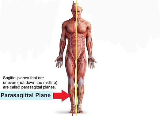 <p>Parasagittal </p>