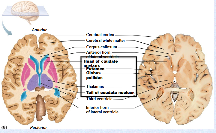 <p>(Caudate nucleus) (Putamen) (Globus pallidus)</p>