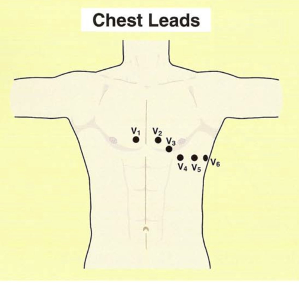 <p>V1, V2, V3, V4, V5, V6</p><p>They are all positive electrodes​.</p>