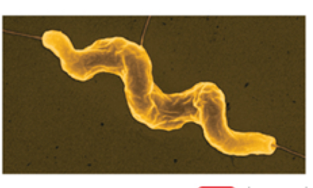 <p>Type of spiral bacteria</p>
