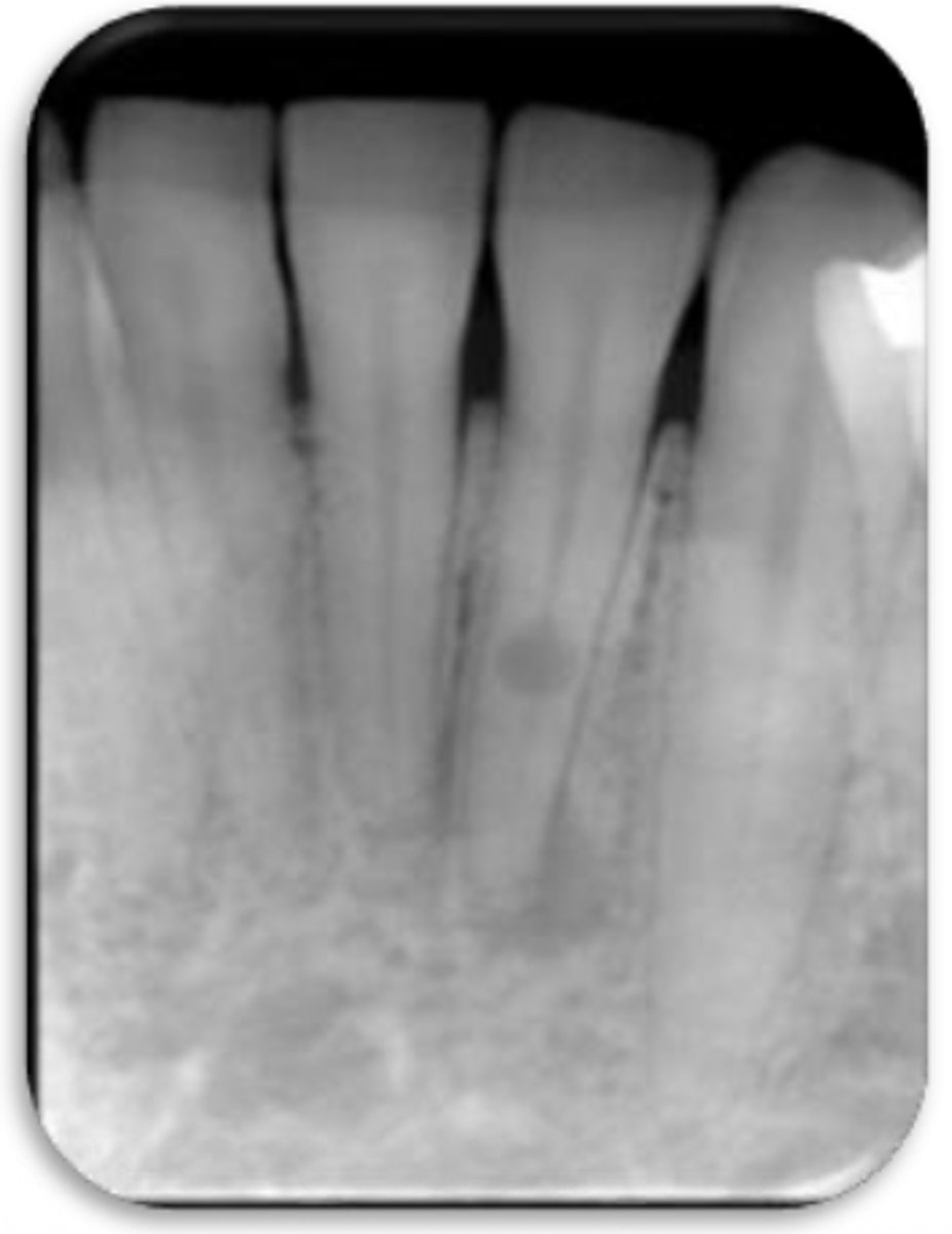 <p>ID the problem:</p>