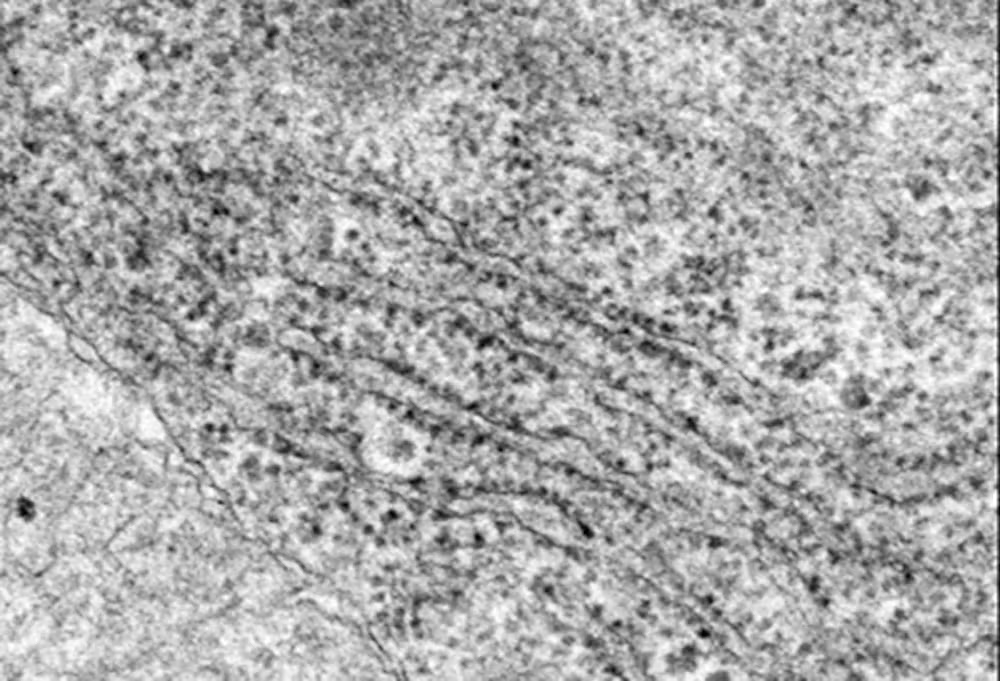 <p>Welk onderdeel van de cel is dit?</p><p>Wat is de functie hiervan?</p>