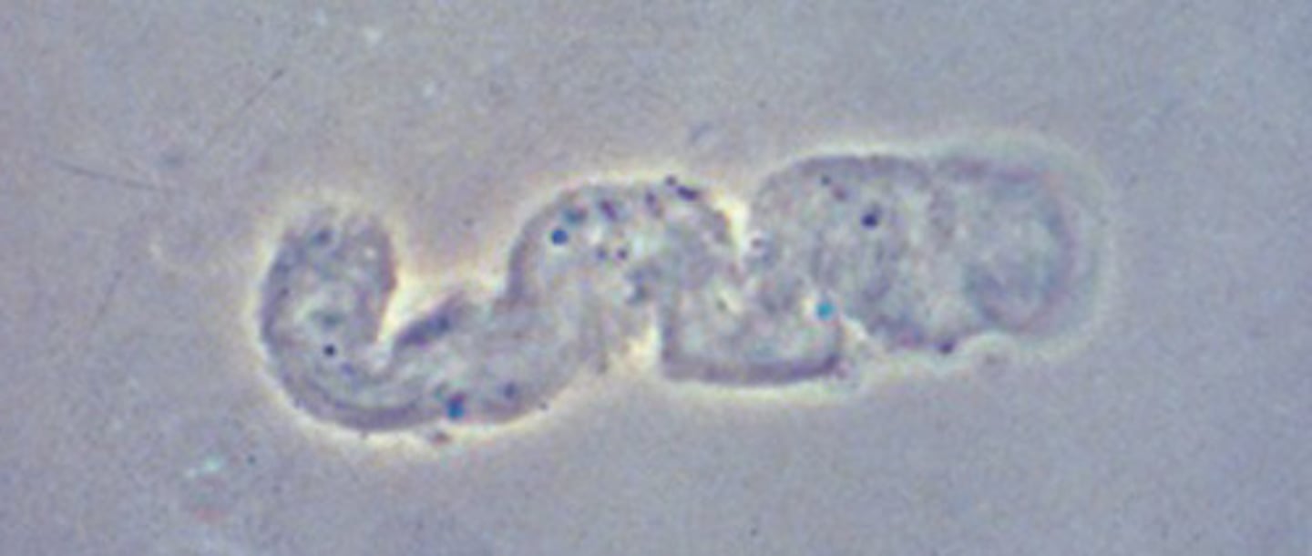 <p>Faint, colorless</p><p>Concentration of mucoproteins secreted from renal tubules</p><p>Non-specific; Present in normal/non- renal disease patients</p>