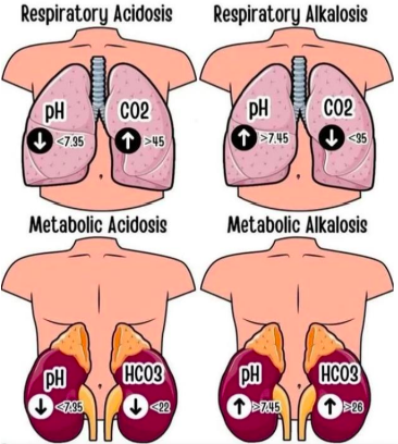 <p>Acidosis:</p><ul><li><p>Respiratory</p></li><li><p>Metabolic</p></li></ul><p>Alkalosis:</p><ul><li><p>Respiratory</p></li><li><p>Metabolic</p></li></ul><p></p>