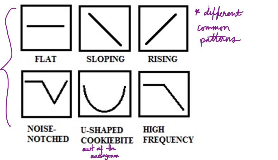 <p>pattern or trend</p><p>ex: flat, rising, sloping, cookie bite, peak</p>