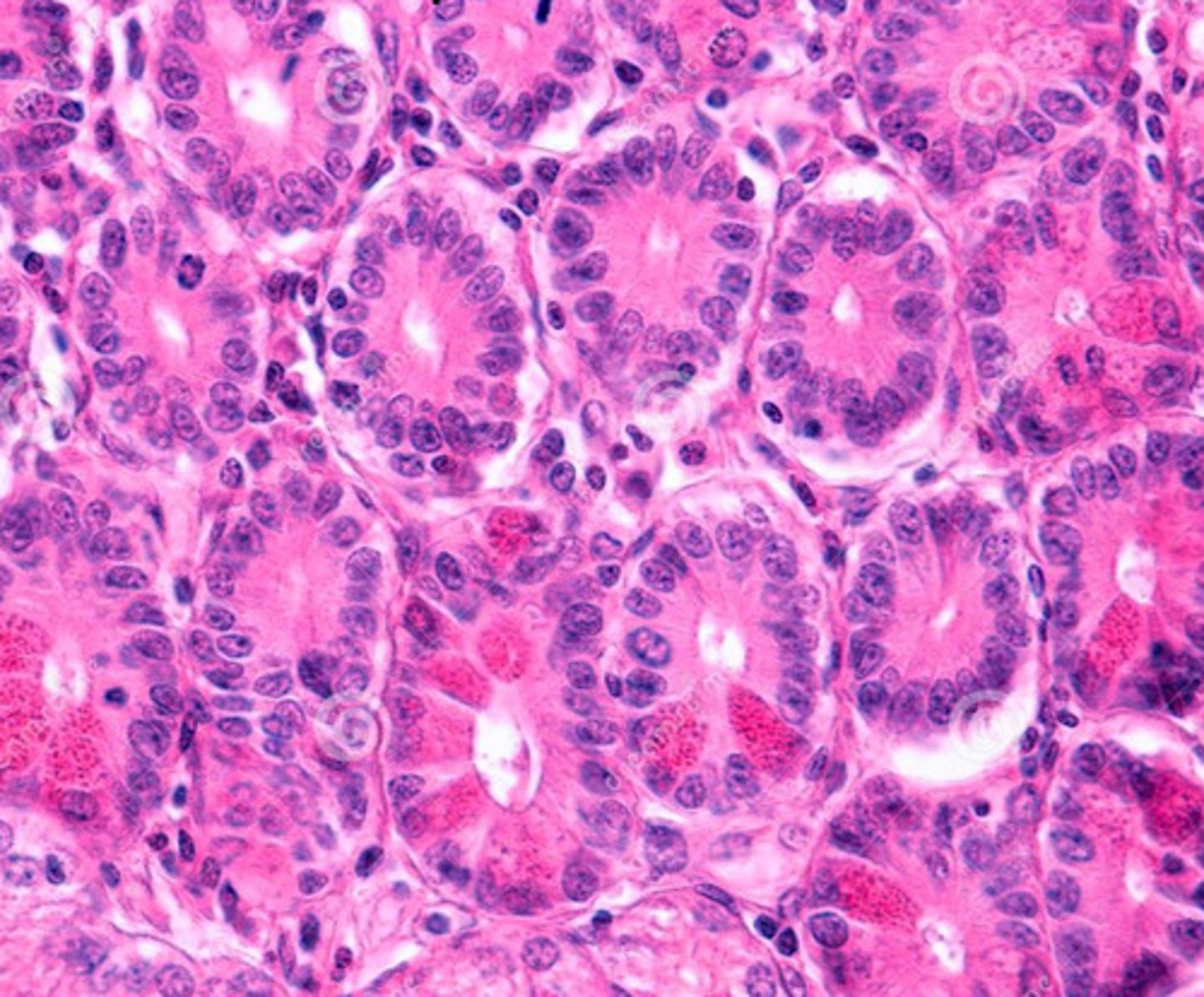 <p>paneth cells</p>