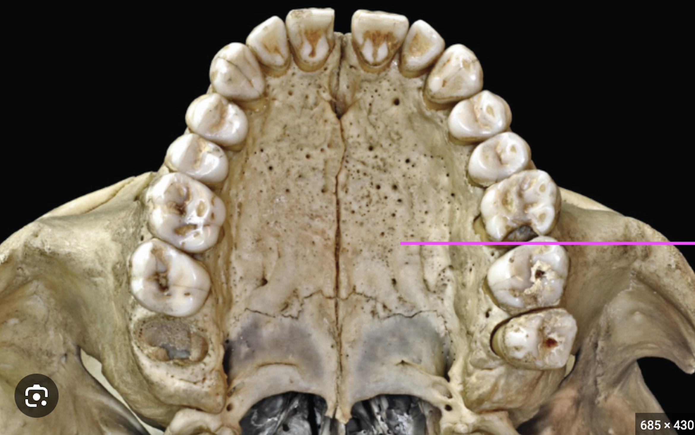 <p>What bone marking is this?</p>