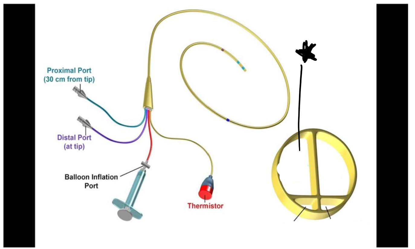 <p>Label this lumen</p>
