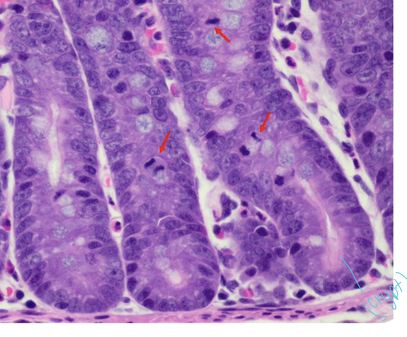**Where can you find Crypts?** 

(Mitotic figures, indicative of replication, are often frequently found within crypts, Red arrow).
