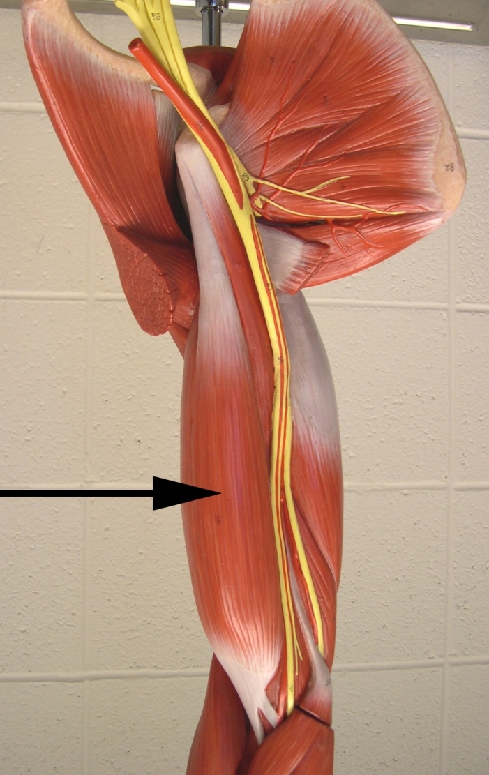 <p>Name the muscle indicated by the arrow</p><p>View: anterior side of the brachial region (upper limb)</p>