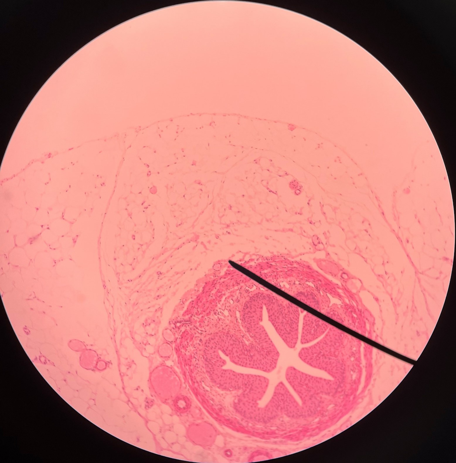 • Slide histology of the ureter.

• The outermost layer of the ureter.

• Composed of connective tissue.

• Superficial to the circular layer of the muscularis.