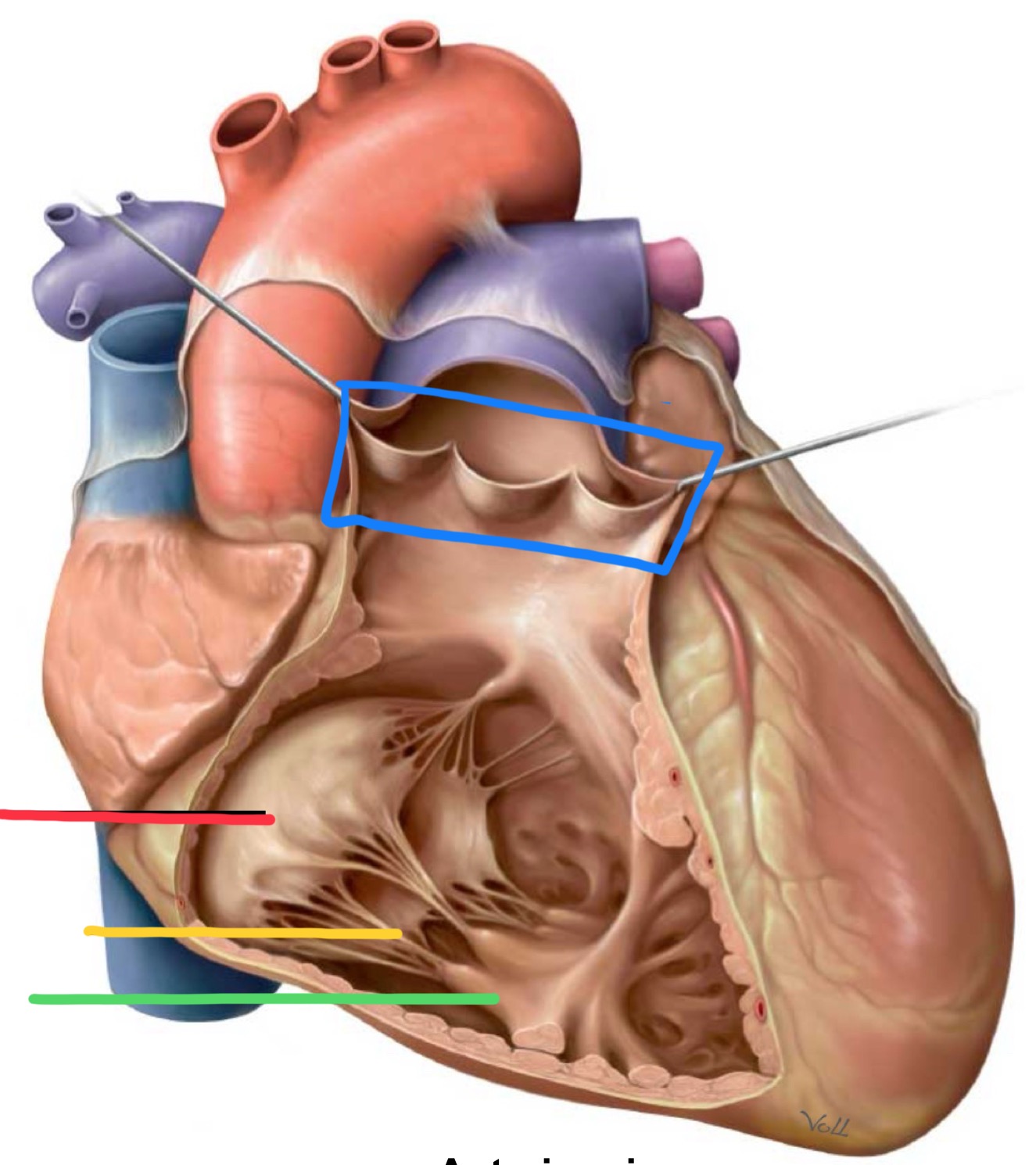 <p>What structure is identified by the red line?</p>