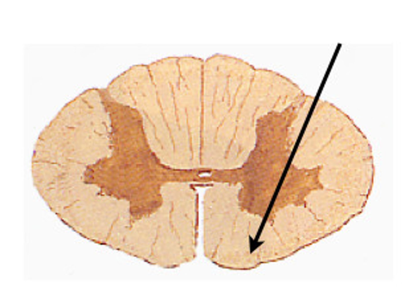 <p>The ventral section of white matter in the spinal cord between the ventral horns.</p>