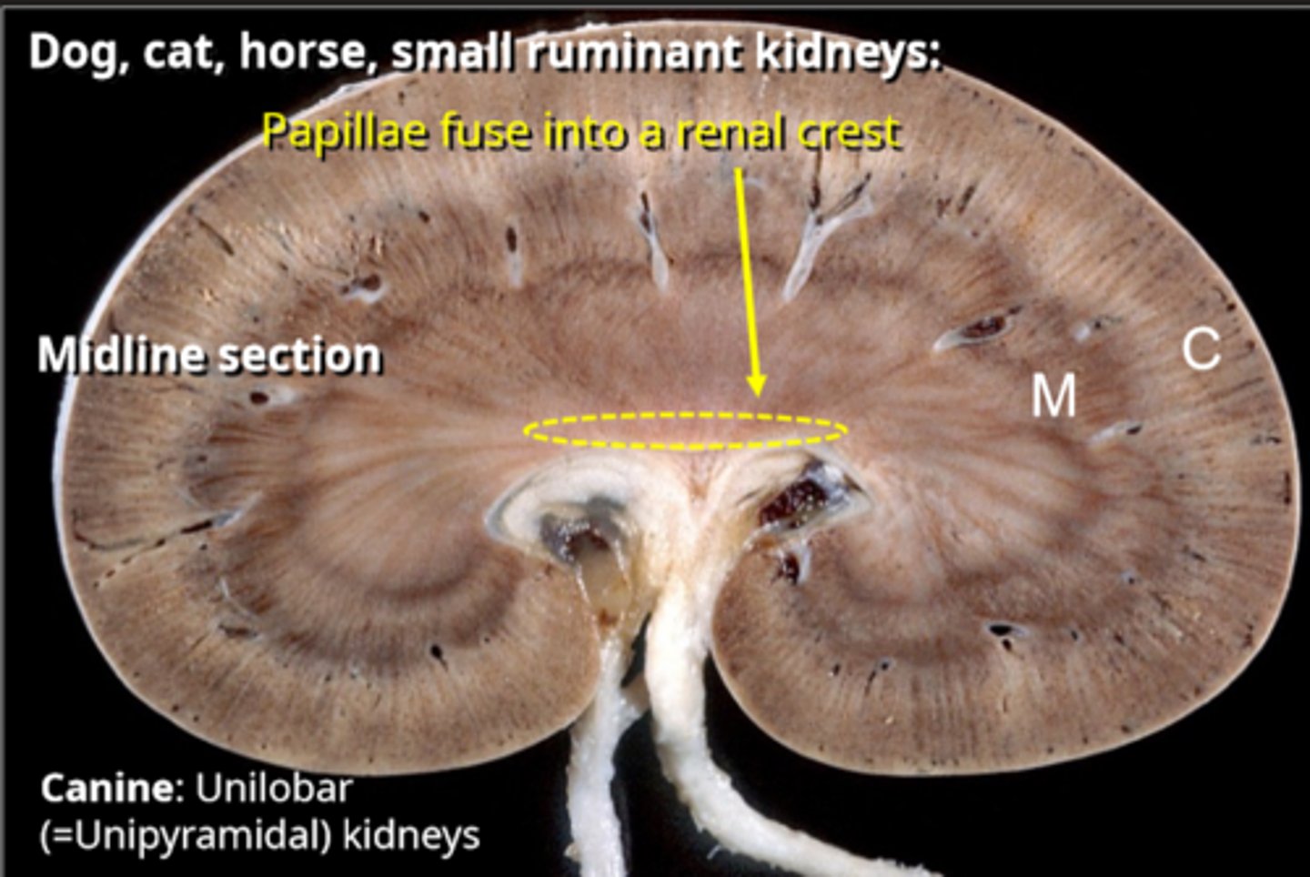 <p>unilobar (unipyramidal) kidneys</p>