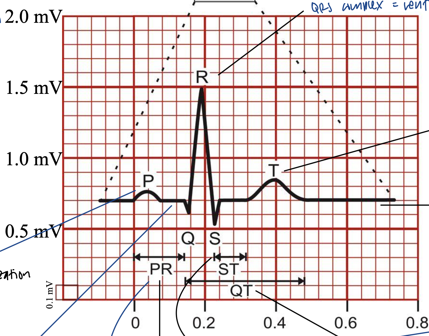 <ul><li><p>ventricular repolarization</p></li><li><p>lasts longer than QRS depolarization</p></li></ul><p></p>