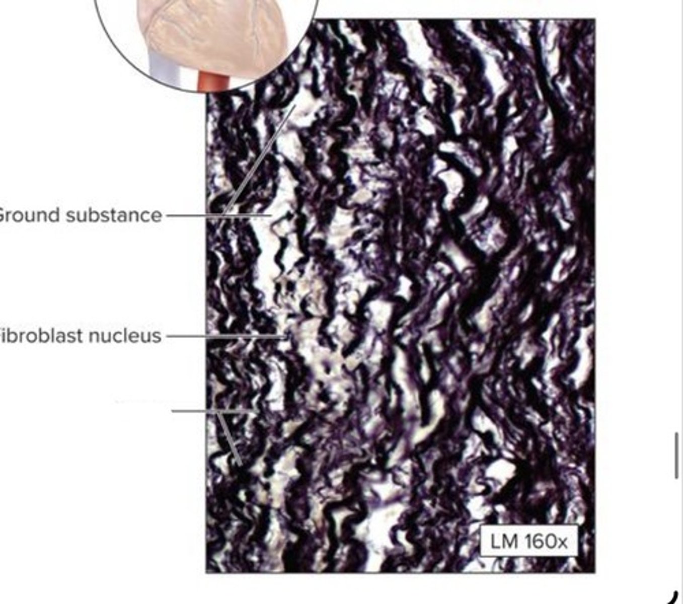 <p>What dense connective tissue is this?</p>