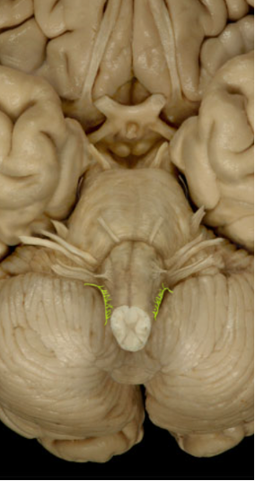 <p>Accessory Nerve (XI)</p>
