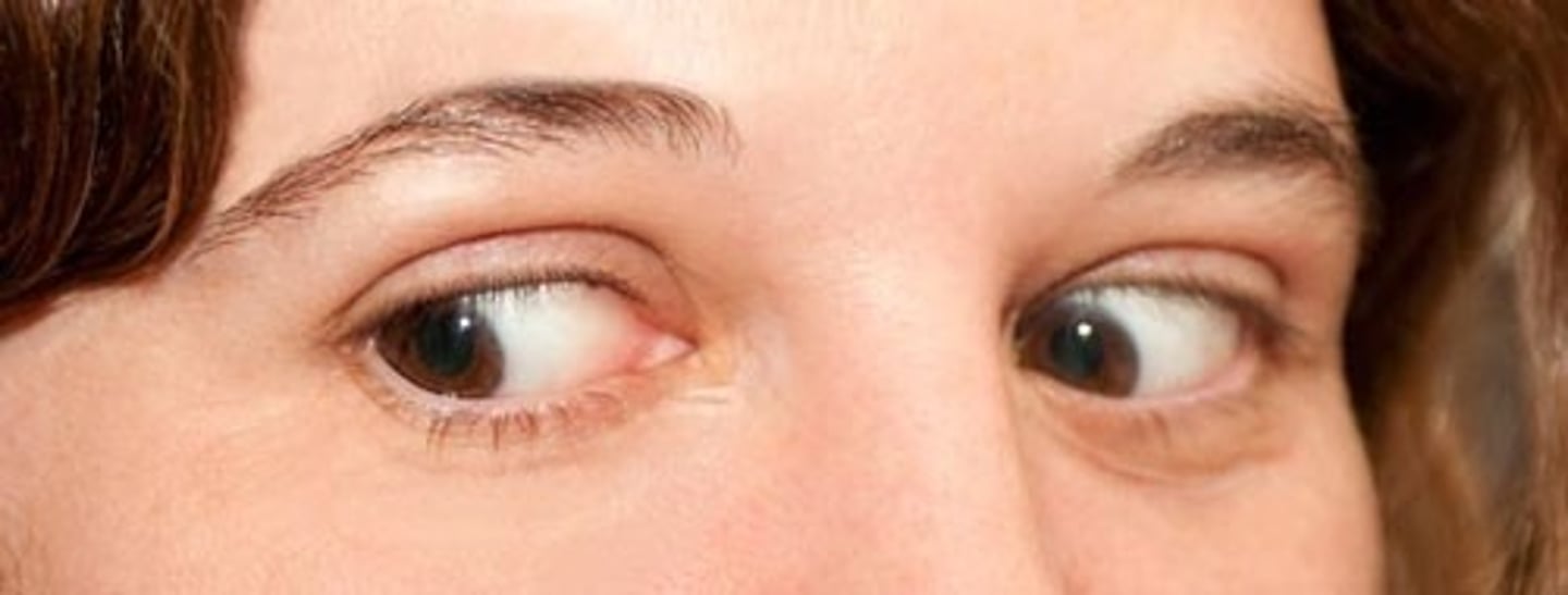 <p>Neurological disorder involving social deficits, communication issues, and repetitive behaviors.</p>