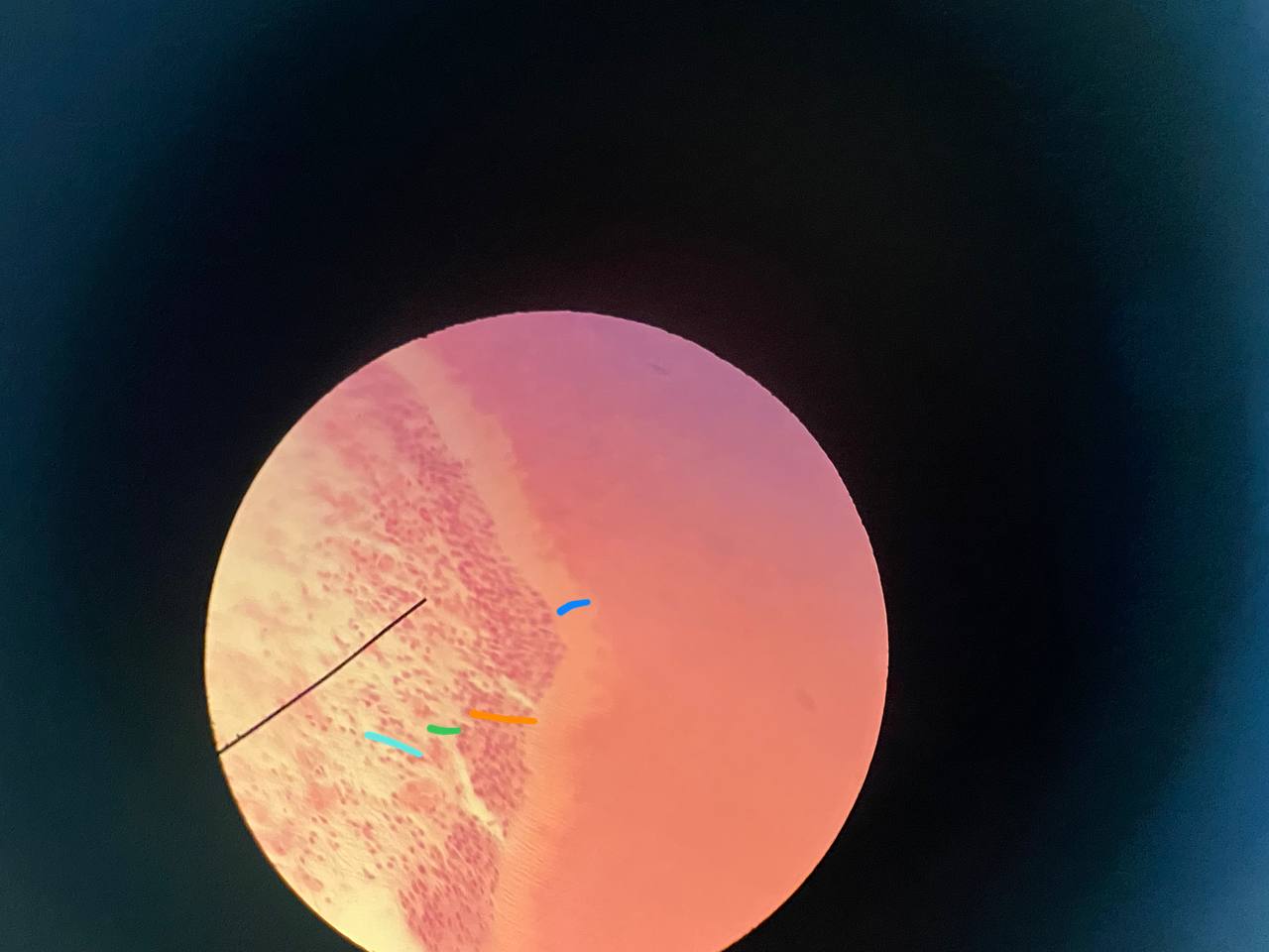 term image