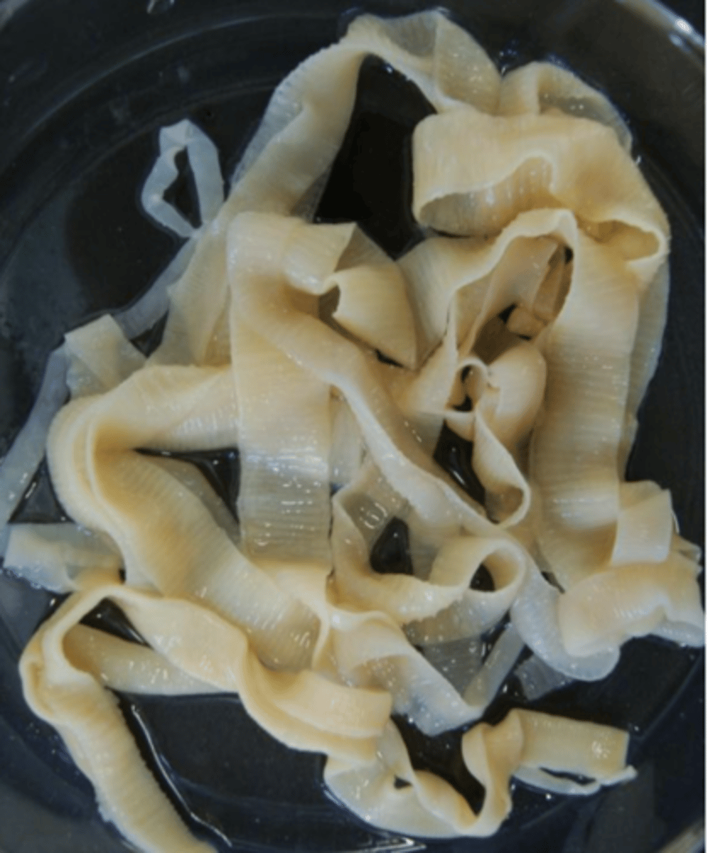 <p>Found incidentally in a sheep PM. What parasite is this?</p>