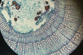 dicot stem