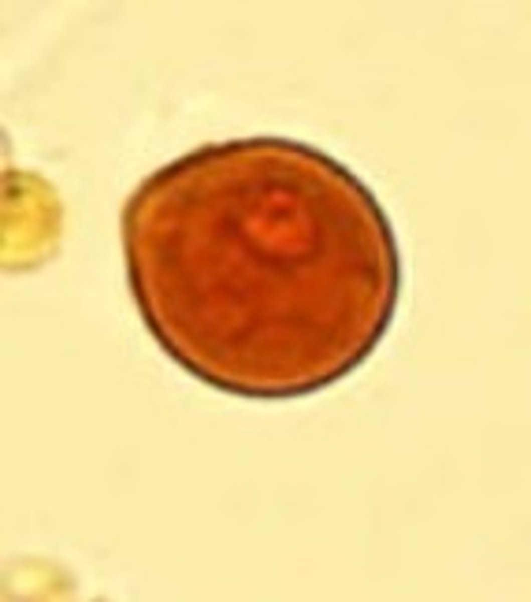 <p>Identify the parasite</p>