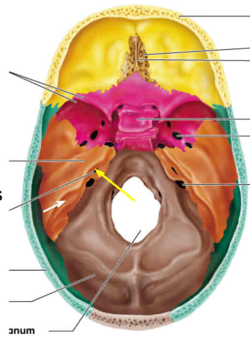 <p>What cranial nerve is indicated?</p>