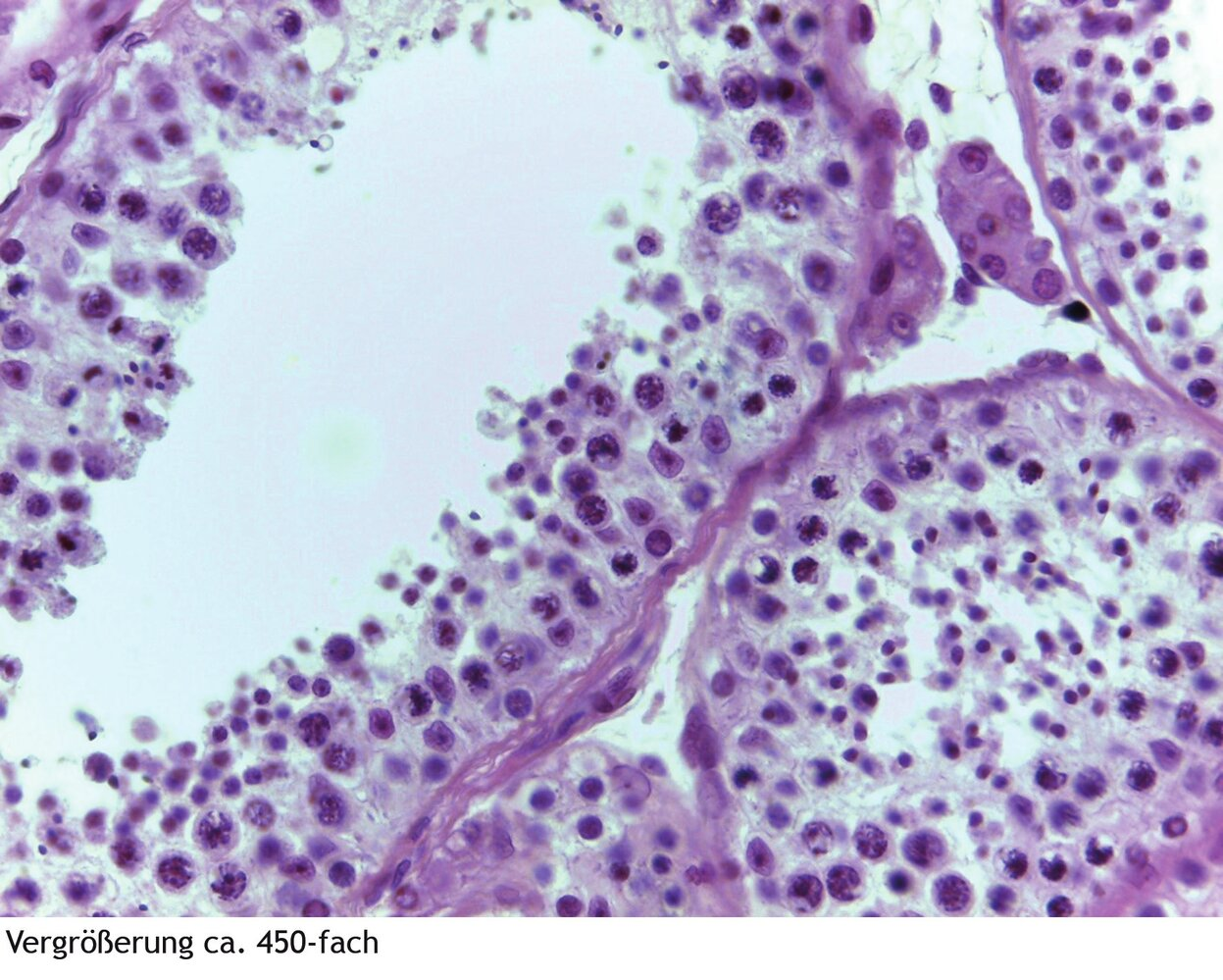 <p>14. Tissue samples from different organ systems can be identified under the microscope or in images by specific features.</p><p>The image shows, among other structures:</p><p>A. Cortex and medulla of the adrenal gland</p><p>B. Ciliated epithelium of the fallopian tube (Tuba uterina)</p><p>C. Germinal epithelium of the testis</p><p>D. Non-keratinized stratified squamous epithelium of the vagina</p><p>E. Transitional epithelium of the urinary bladder</p>