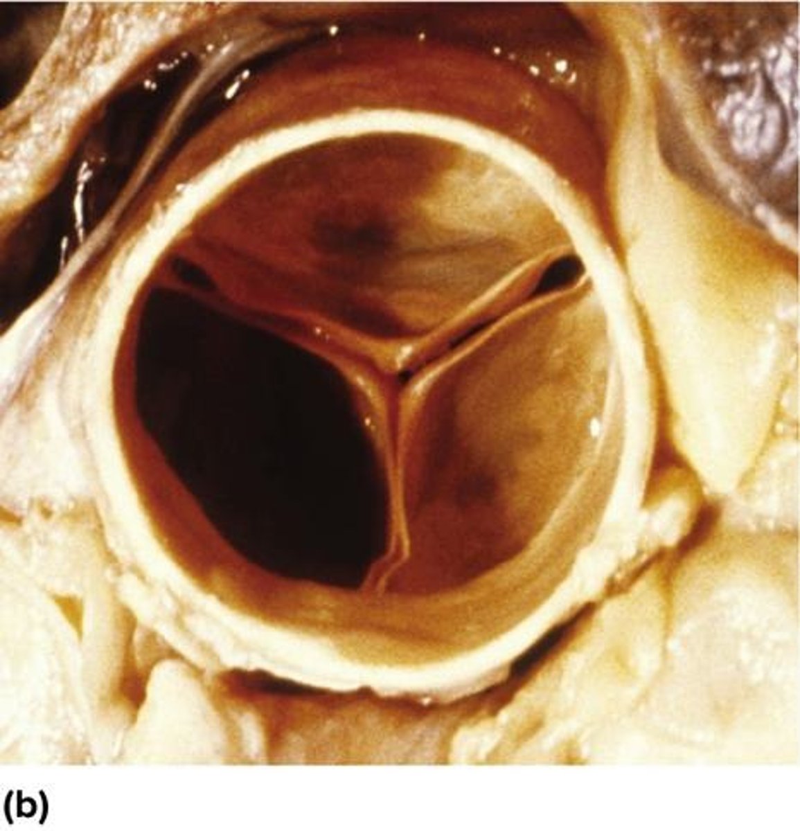 <p>To ensure one-way flow of blood through the heart.</p>