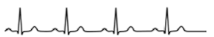 <p>ECG - What is this?</p><p>Describe it</p>
