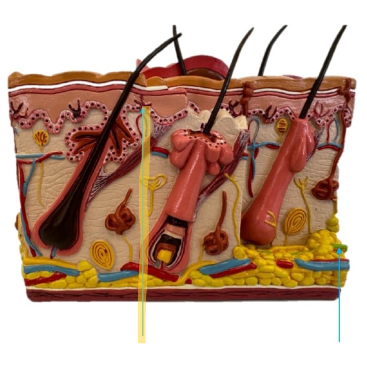 term image