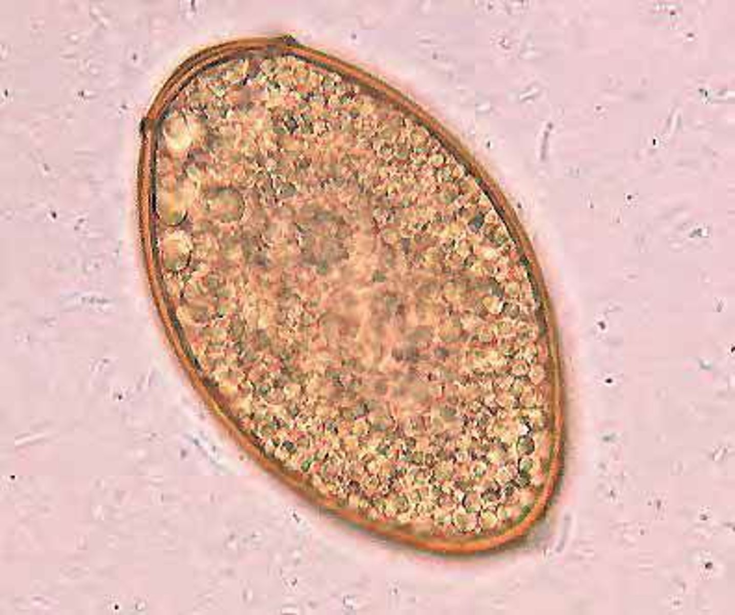 <p><span>This was found in the stool sample of a coughing cat.&nbsp;&nbsp;What is it?</span></p>