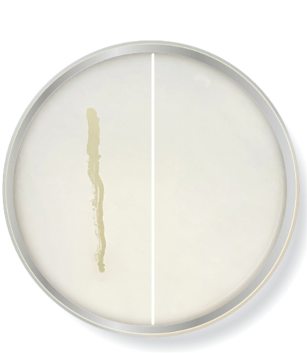 <p>this is a halo INTOLERANT bacteria (right side of image)</p>