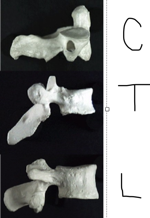 <ul><li><p><span style="font-family: Calibri">Horizontal: Cervical, Low Thoracic, Lumbar</span></p></li><li><p><span style="font-family: Calibri">Caudad angulation: Thoracic</span></p></li></ul>