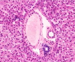 <p>What do the bile duct, hepatic artery, and hepatic portal vein make up?</p>