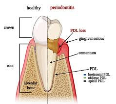 <ul><li><p>suspends tooth in its alveolar socket</p></li><li><p>fibres<strong> bridge alveolar bone and cementum</strong></p></li><li><p>shaped to accomodate tooth root-may be branched</p></li><li><p><strong>lined by compact bone</strong></p></li></ul><p></p>