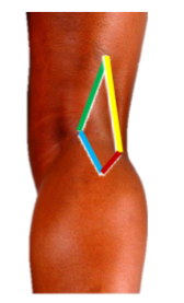 <p>Fat-filled space posterior to knee joint</p>