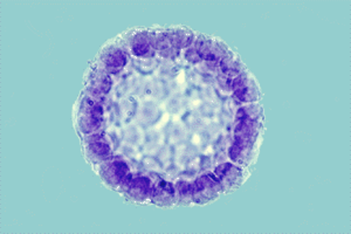 <p>immature cell</p>
