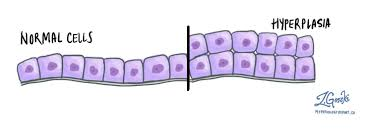 <p>increase in <strong>number </strong>of cells&nbsp;</p>