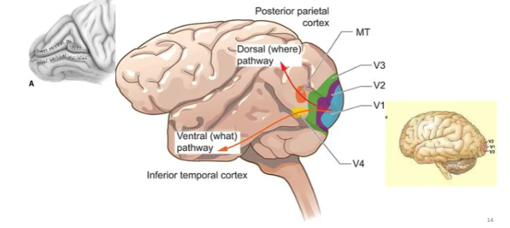 <p>A prominent groove on the medial surface of the occipital lobe of the brain, crucial for vision as it houses the primary visual cortex (V1), separating the cuneus above from the lingual gyrus below, with damage potentially causing blindness in half the visual field (hemianopia).  </p>