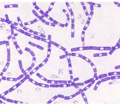* forms large colonies over 3 mm wide
* usually off-white, opaque, and often waxy-looking
* large, gram-positive bacillus
* spores may be visible as poorly stained oval swellings
* one of the most common genera of decomposers