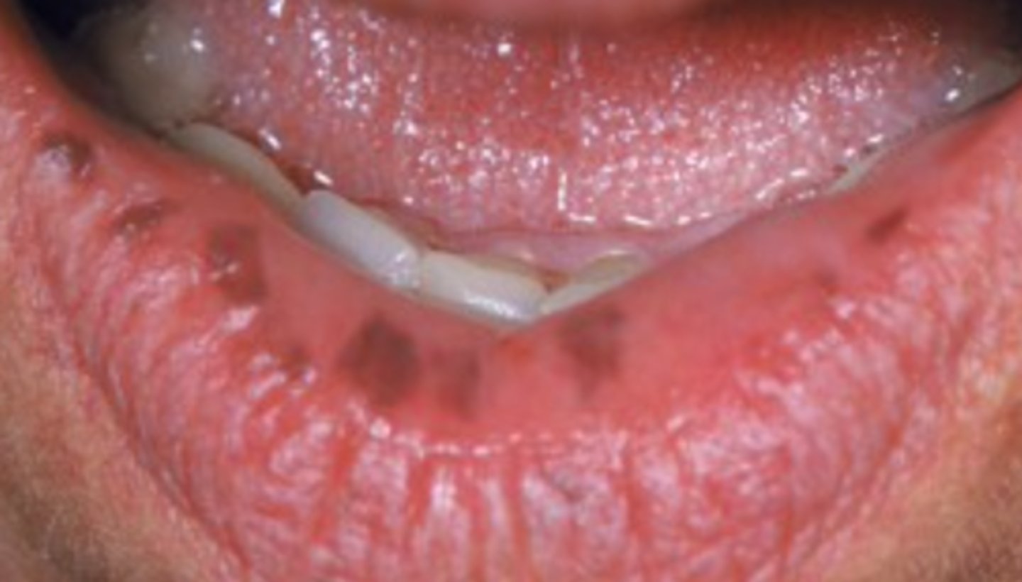 <p>What is the diagnosis?</p>