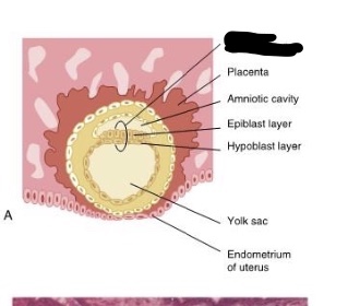 <p><span> A </span><strong>____________<span> </span></strong><span>is </span>eventually developed from the <span>blastocyst and appears as a three- dimensional but flattened, essentially </span>circular plate of bilayered cells. After its creation is is suspended in the endometrium lining between two amniotic cavities.</p>