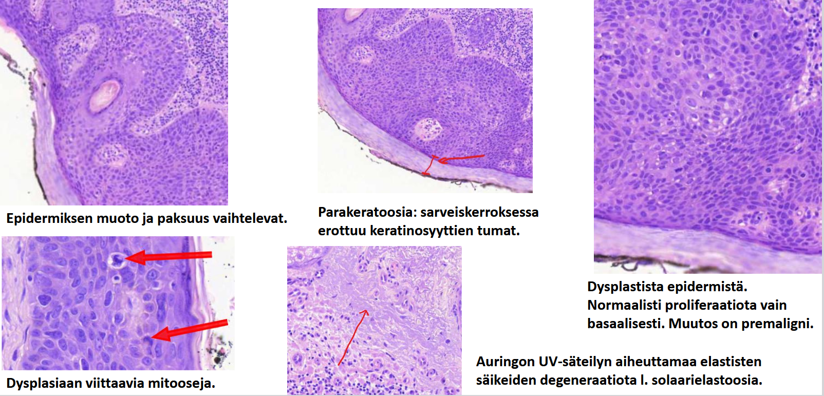 <p>päättele kuvien ja tekstien avulla, mikä tauti on kyseessä?</p>